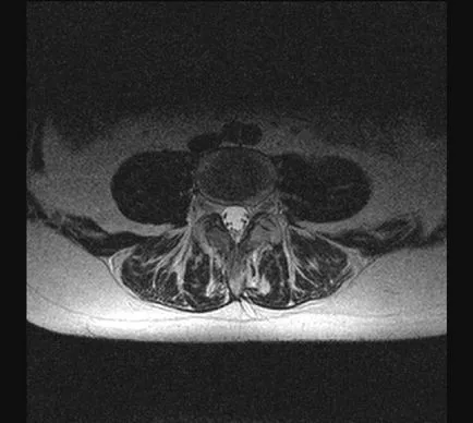 MRI на гръбначния стълб, в центъра на Dikulja