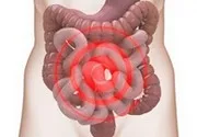 Enterocolitis okok, tünetek, tünetei és kezelése