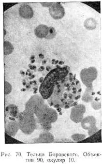 Pendinskaya fekély (Bohr-kór)