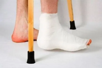Törés a láb, patahenger csont tünetei és kezelése, mit kell tenni, a nyugalmi időszak