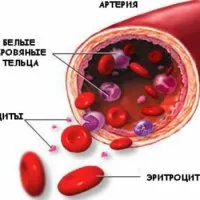 Miért gyermek szenved leukémia vér leukémia okai