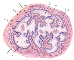 Perioada postoperatorie după îndepărtarea adenomul de prostata este absolut usor!