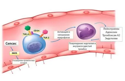 Septicemia (septicemie) - simptome, tratament, prevenire