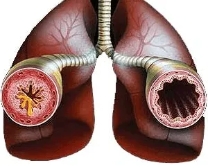 astm atopic, alergic, tuse