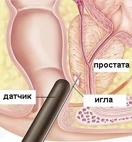 Thai гореща стволови масаж