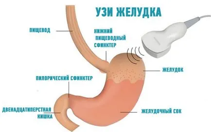 Узи стомаха както резултатите, подготовка, как се извършва, и че показва симптоми