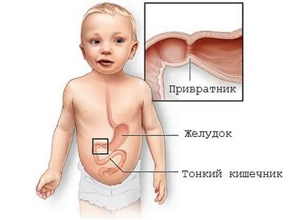 Узи стомаха както резултатите, подготовка, как се извършва, и че показва симптоми