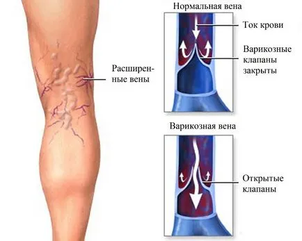 Varifort от разширени мнения и препоръки за ползване