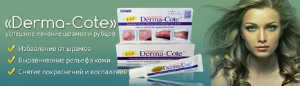 Gel derma-cote (irha cat) hegek