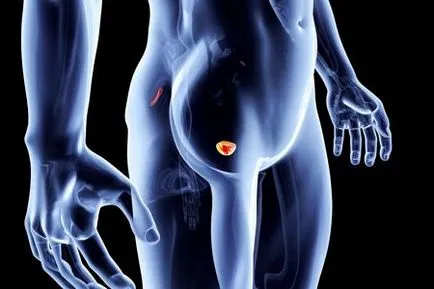 Херпесна простатит (простатата херпес) Симптоми и лечение