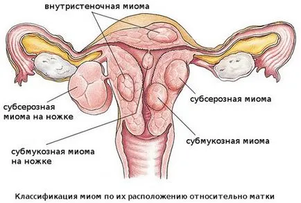 Къде е най-шийката бременността