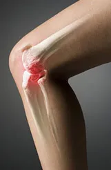 chirurgie artroscopica pentru osteoartrita a genunchiului