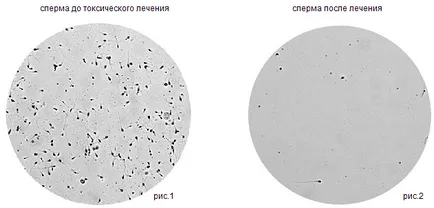 Безплодието в онкологията