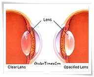 Celamig Гоз Lazer kliniği