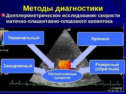 плацентарна дисфункция