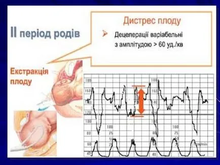 placenta diszfunkció