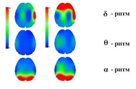 ЕЕГ изпълнение на мозъка декодиране