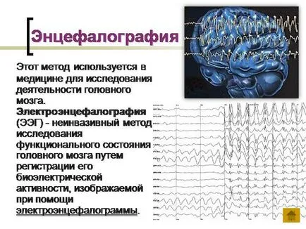 ЕЕГ изпълнение на мозъка декодиране