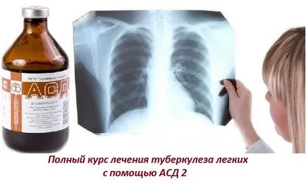 ASD 2. frakció pulmonalis tuberculosis, hogyan kell teljes kúra, ellenjavallatok