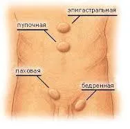 Хернии симптоми, лечение, описание