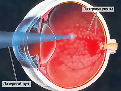 Clinica Iris Eye