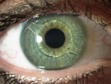 Clinica Iris Eye