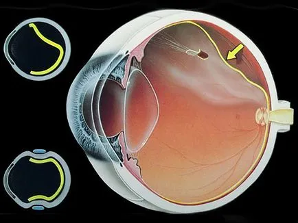 Clinica Iris Eye