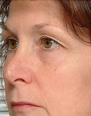 Крем за стягане на кожата на лицето - изберете най-доброто, подмладяване на кожата