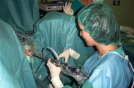 Cu laser în urologie