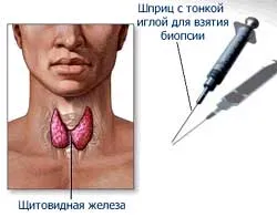 Metode de diagnostic endocrine