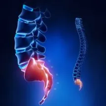 RMN și CT coloanei vertebrale