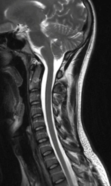 MRI на гръбначния стълб в Перм