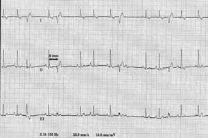 Aritmiei la câini - Simptome si tratamentul aritmiilor cardiace la câini de la Moscova