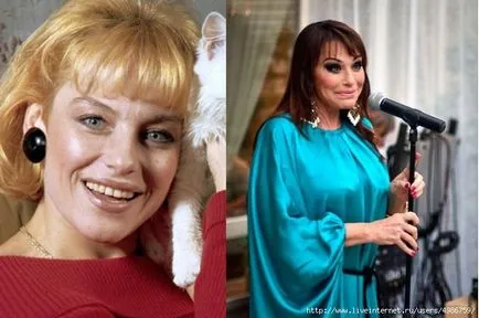 Ринопластика снимки на известни личности преди и след операция