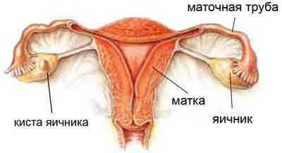 Sebaceous ciszták ez, és hogyan kell kezelni