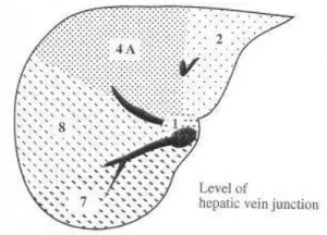 Szegmensek máj ultrahang (Lecture on diagnostere)