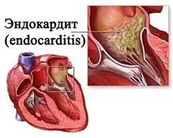 Simptomele și tratamentul bradicardiei, care utilizează o tabletă