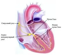 Tünetei és kezelése bradycardia, amely a tábla