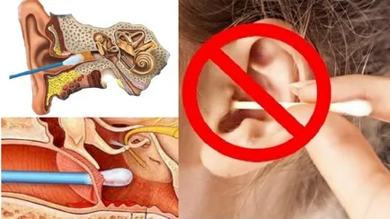 Загуба на слуха причини и лечение на загуба на слуха