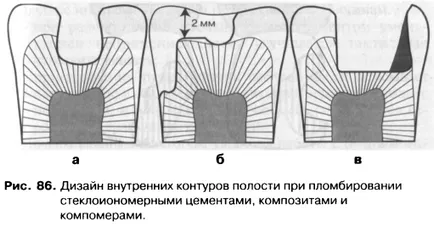 Методите и принципите на получаване на кухини - добра дентална портал, добри