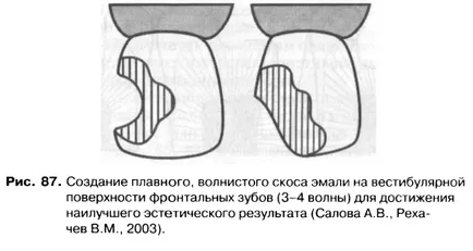 Методите и принципите на получаване на кухини - добра дентална портал, добри