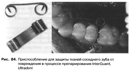 Методите и принципите на получаване на кухини - добра дентална портал, добри