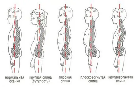 Какъв вид поза е нормално