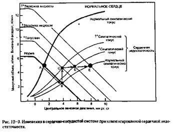 Хронична застойна сърдечна недостатъчност