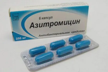 Staphylococcus aureus în antibiotice gât