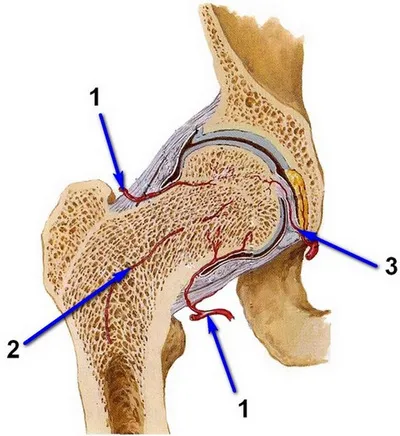 Алтернатива (нехирургично) третиране на некроза на феморалната глава конвенционална лекарствена