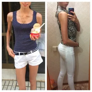 Az anorexia a történet az én betegség, WLS