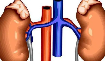 Apostematozny pielonefrita cauze, simptome, diagnostic, tratament