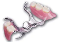Clasp protezelor dentare „pro“ și „contra“