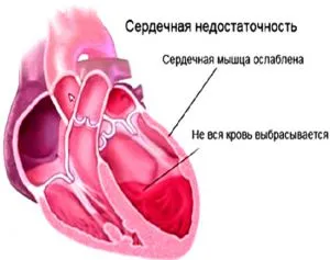 Колкото по-опасни ангина по време на бременност при фетални ефекти